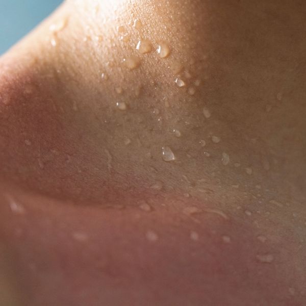 Що потрібно знати про захист від сонця та сонячний дерматит?