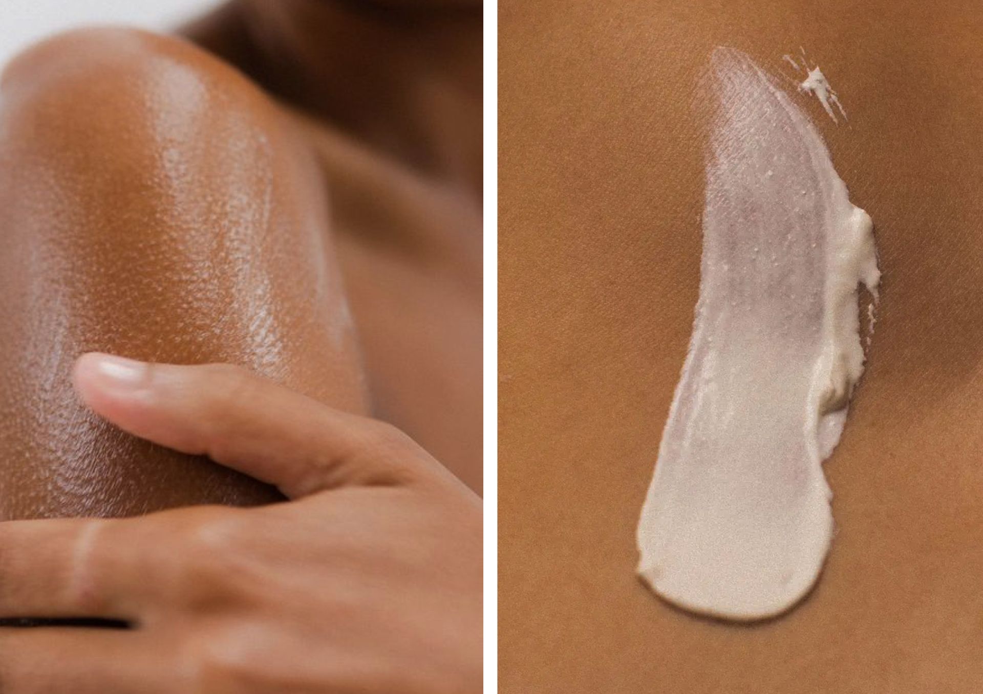 Мікробіом шкіри: що це і чому він важливий?